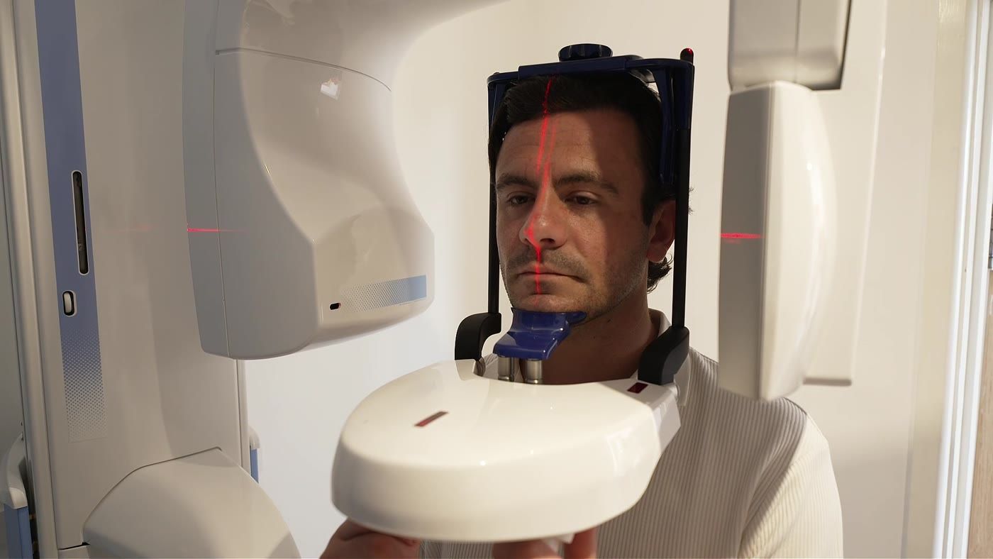 CBCT scanner