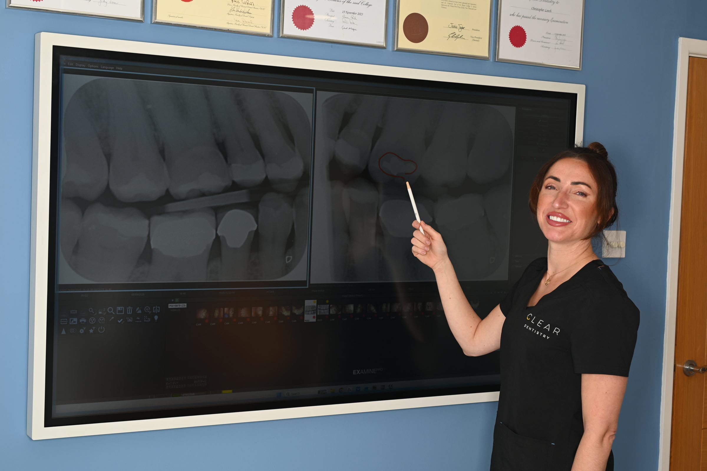 Cherrish Collins talking through bitewing X-rays on the large wall screen