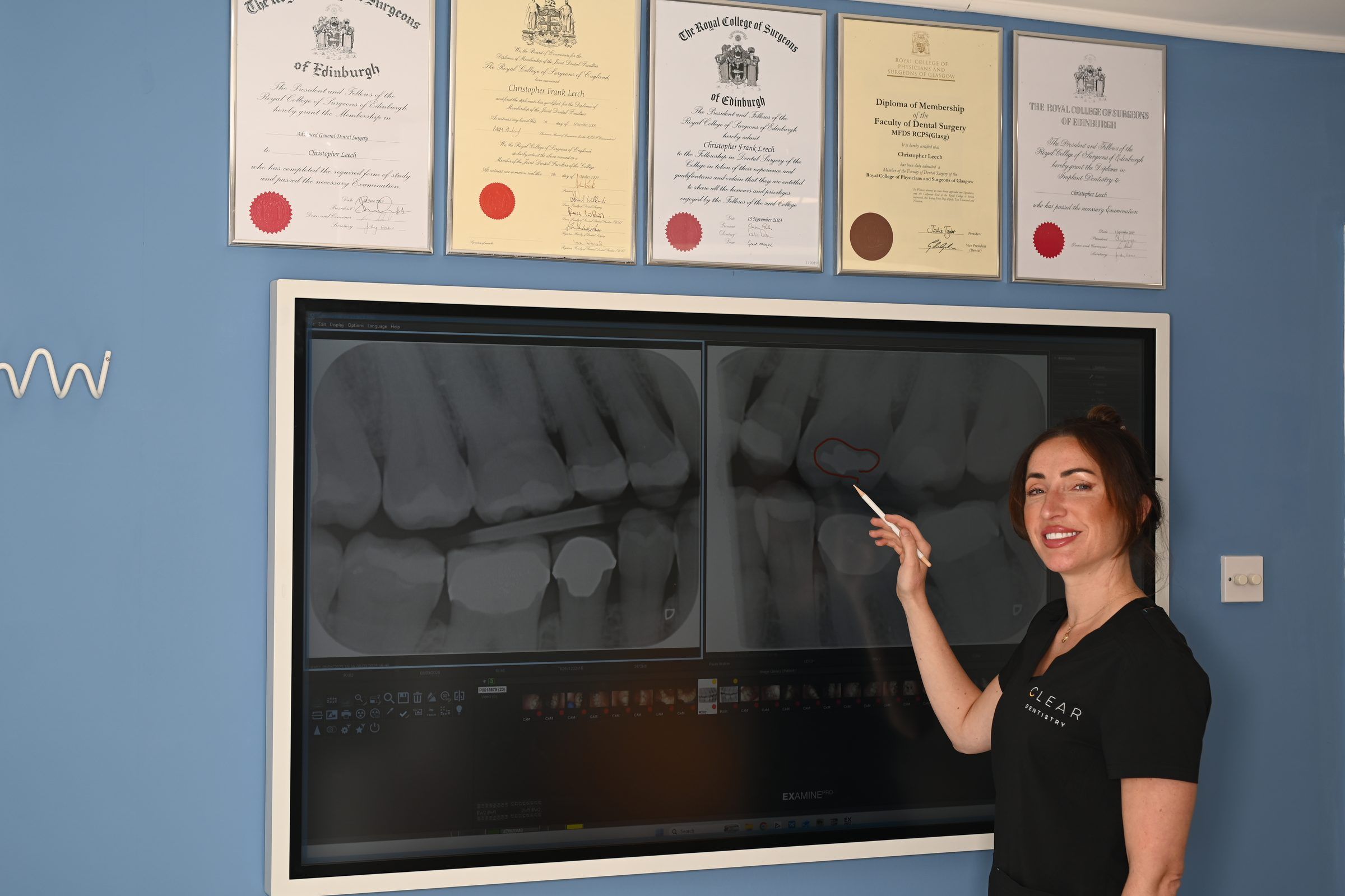 Radiographs shown on the chairside wall screen