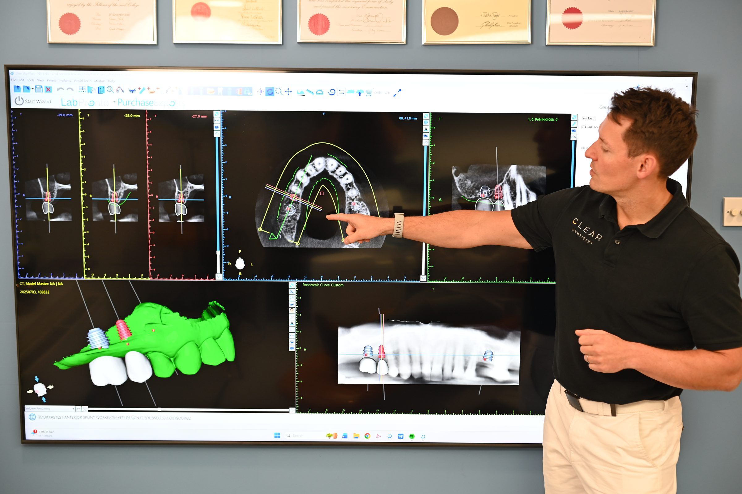 Dr Chris Leech pointing out implant positions on a 3D CBCT scan